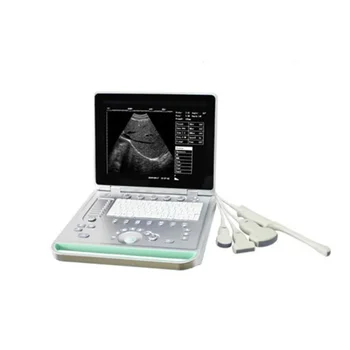 medicininiai UItrasound instrumentai nešiojamas ultragarso aparatas b / w nešiojamas ultragarsinis skaitytuvas